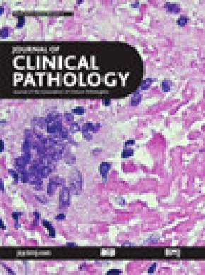 Journal Of Clinical Pathology期刊