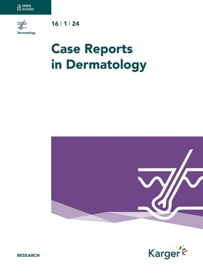 Case Reports In Dermatology期刊